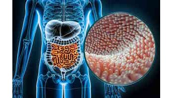 Studio internazionale rivela l'impatto delle diete sul microbioma intestinale