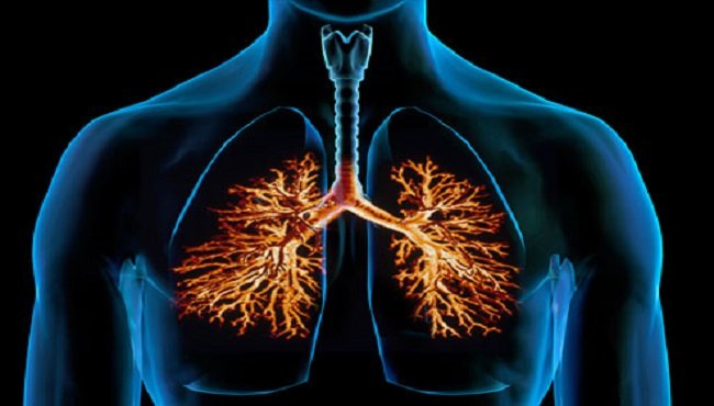 Bronchite: sintomi e complicazioni dell'infiammazione