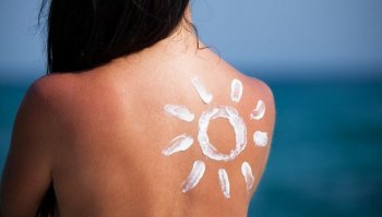 Scottature del sole: come curarle con soluzioni naturali