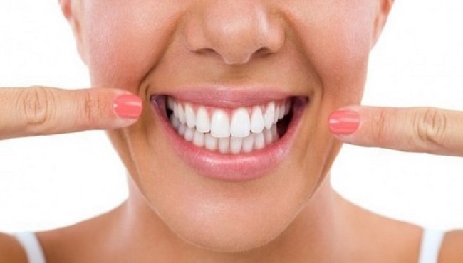Sbiancamento denti: come rendere la propria dentatura perfetta in modo naturale