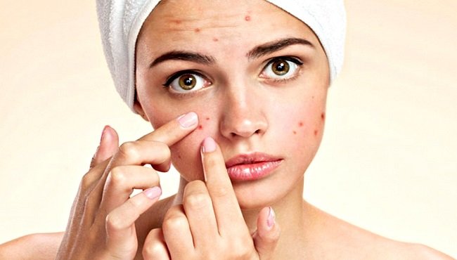 Rimedi naturali contro brufoli e inestetismi: 5 modi per avere una pelle perfetta